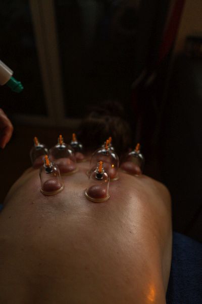 Schröpfmassage mit Glasbank bei Paradisum Massage in Geesthacht – die Bänke erzeugen Unterdruck zur Muskelentspannung und Förderung der Durchblutung.